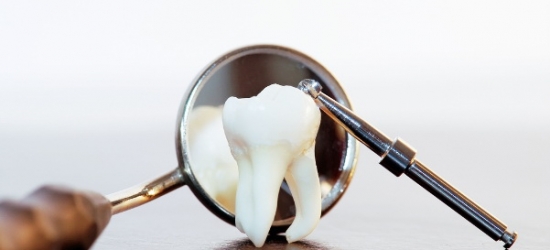 Мифы про удаление зубов
